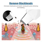 Spatule Nettoyante Visage — Peeling Ultrasonique Anti-Points Noirs