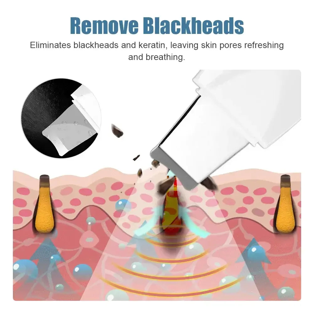 Spatule Nettoyante Visage — Peeling Ultrasonique Anti-Points Noirs