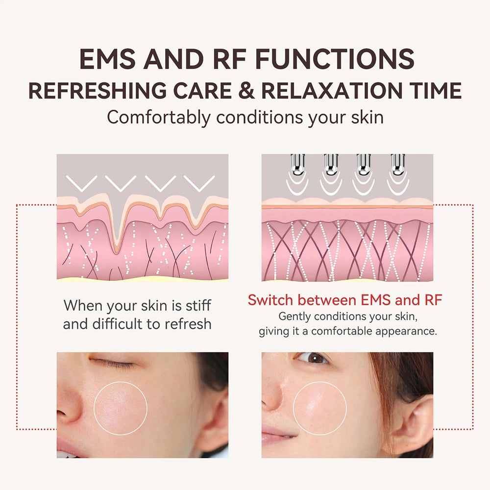 Masseur Visage ANLAN RF + EMS — Double Tête Anti-Fatigue & Fermeté